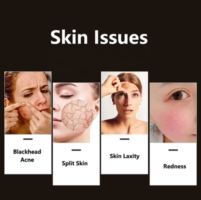 Compacte huid led gezichtslicht therapie voor acne verbetering professionele graad