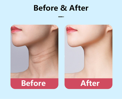 Gezichtsmicrocurrent EMS Neck Face Lifting Massager Multifunktioneel schoonheidsapparatuur