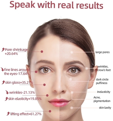 USB-opladen Oogstok Licht Therapie Stok Ems Vibrating Face Massager Lifting Eye 46G